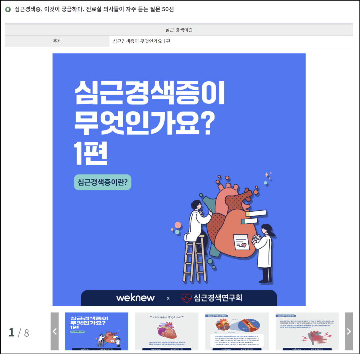 심근경색증, 이것이 궁금하다. 진료실 의사들이 자주 듣는 질문 50선 이미지