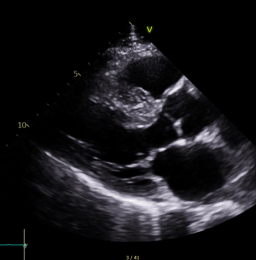 Introduction of the Hypertrophic Cardiomyopathy (HCM) Research Group