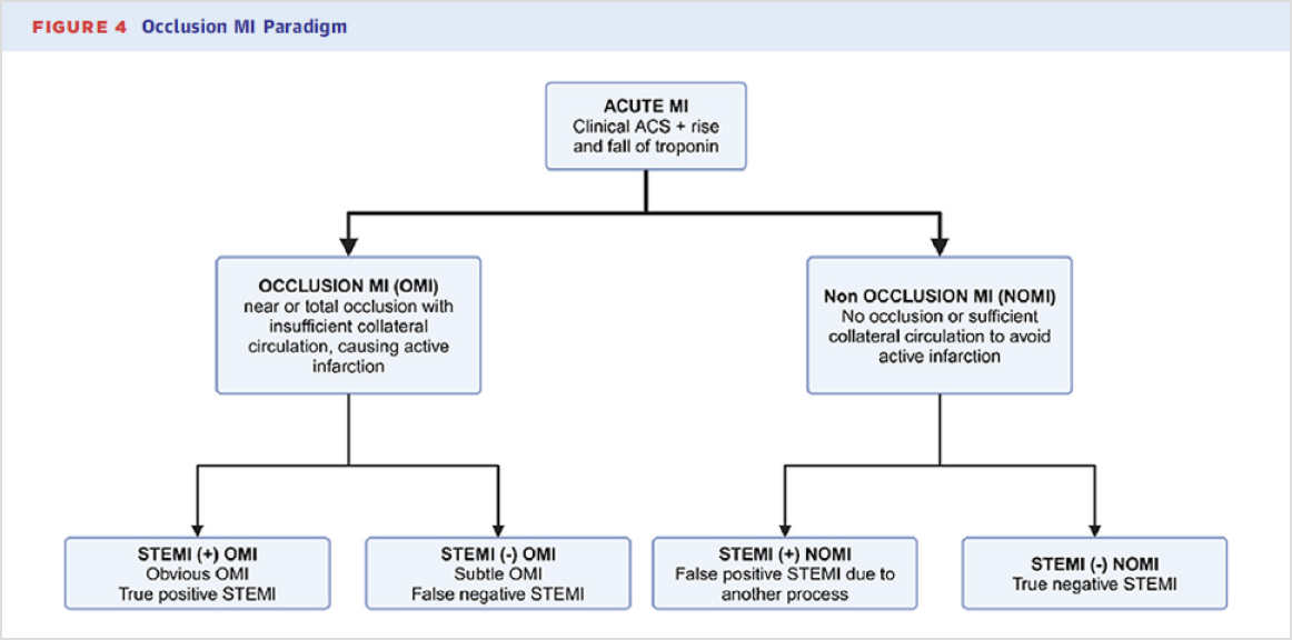 STEMI/Non-STEMI의 잘못된 이분법 & Crisis